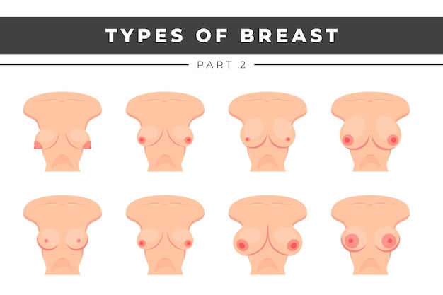 Premium Vector  Types of breast vector illustration breast anatomy