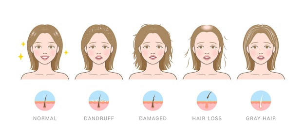 types of hair problems normal dandruff damaged hair loss and gray hair