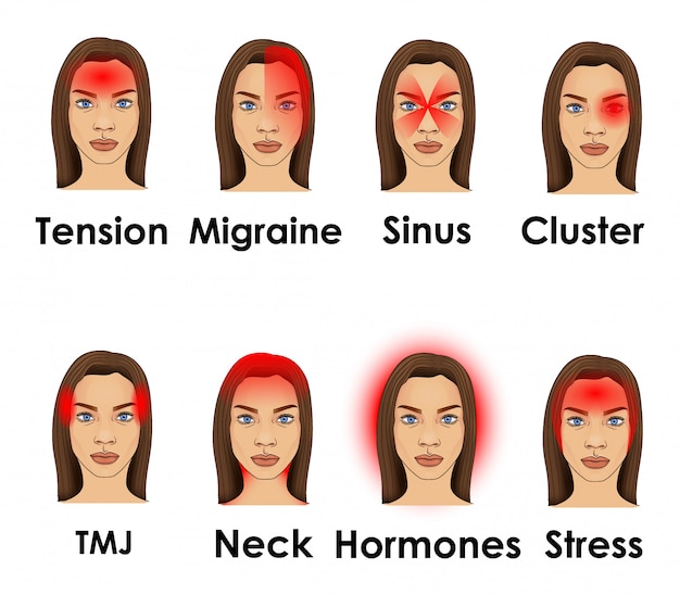 Vector types of headache illustrated on a woman face