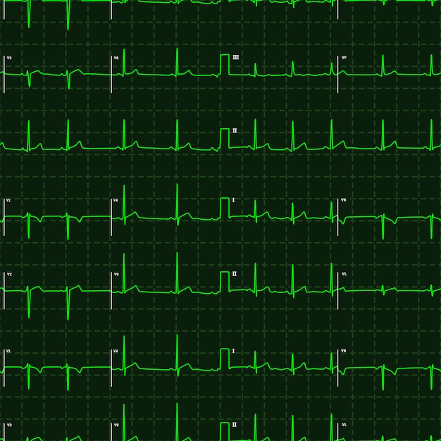 Typische menselijke elektrocardiogram groene grafiek op donkere achtergrond, naadloos patroon