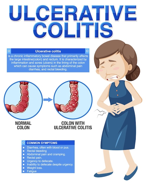 Vettore infografica sui sintomi della colite ulcerosa