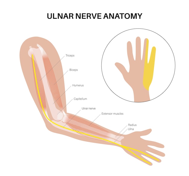 Ulnar nerve anatomical poster