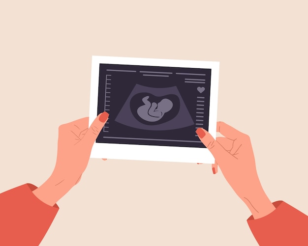 Ultrasound van de baby Vrouwelijke handen die de foetus vasthouden silhouet foto Embryo