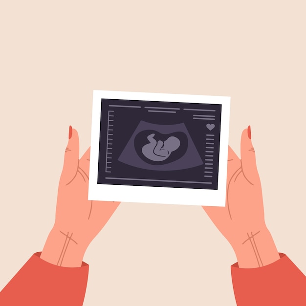 Ultrasound van de baby