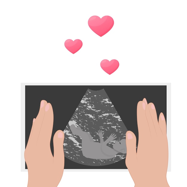 Ultrasoundonderzoek Procedure Zwangerschap Een embryo in een ultrasound scan