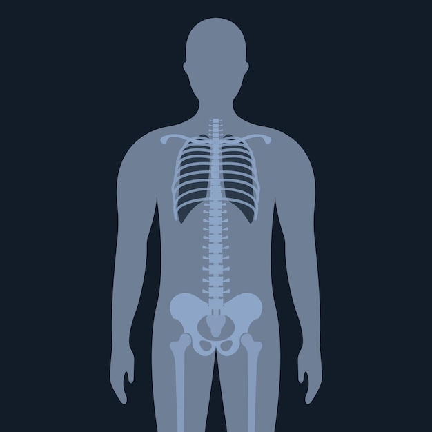 Upright Chest X-Ray for Medical Research and Teaching