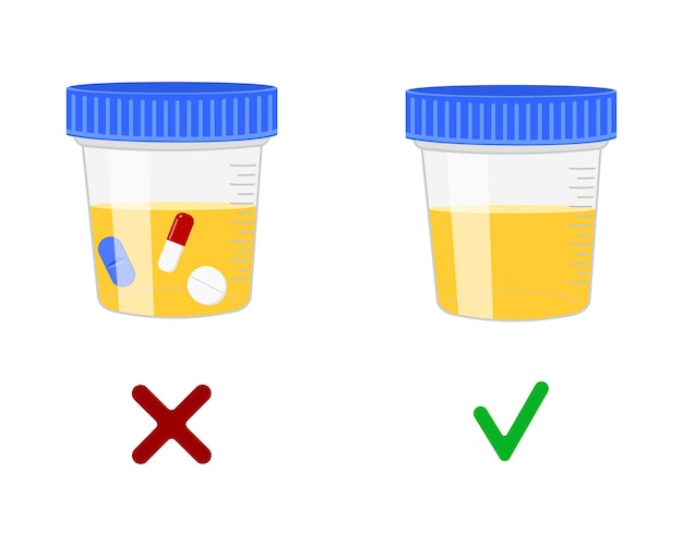 소변 검사, 약물이 있거나 없는 소변 샘플. 스포츠에서의 도핑 제어, 사고 후 약물 테스트 개념. 벡터 만화 그림입니다.