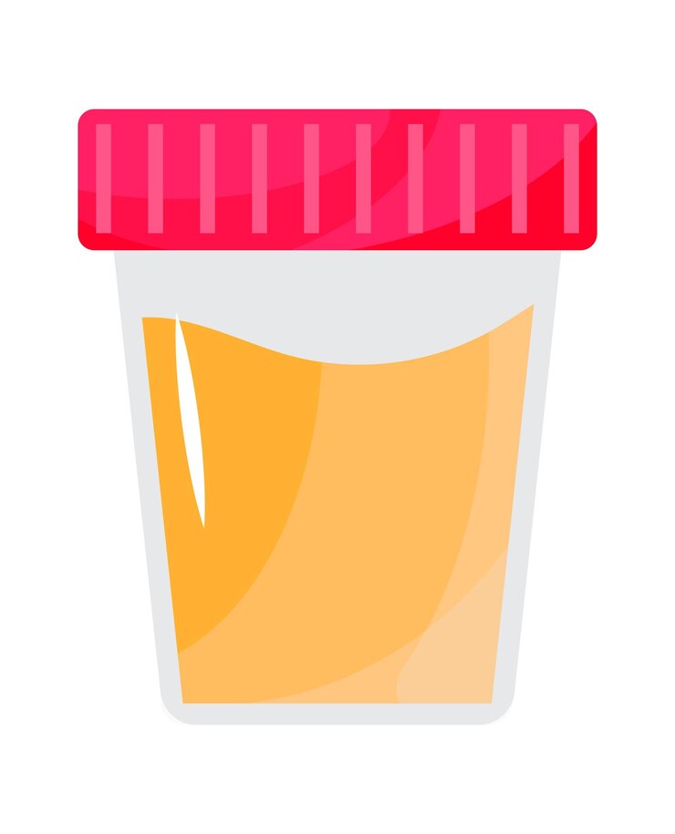 Vector urinalysis vector urine collection container with red lid isolated on white background