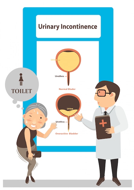 Urinary incontinence illustration