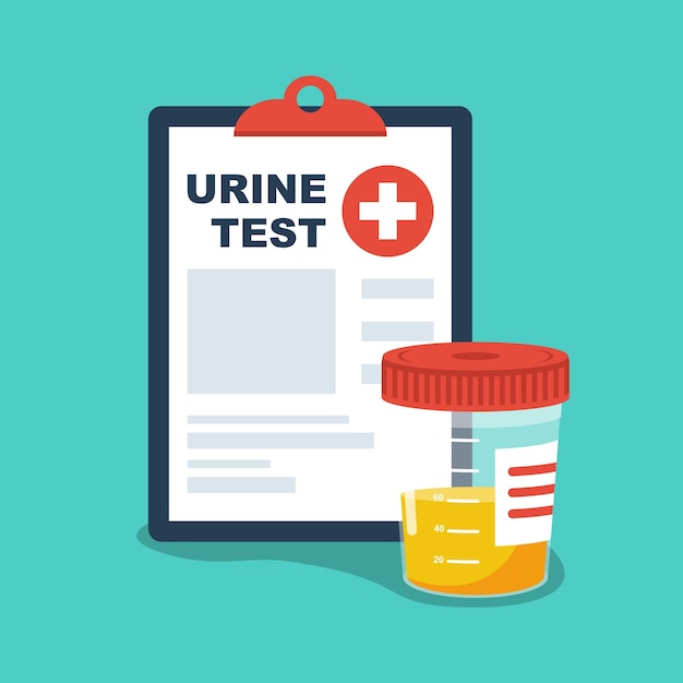 Urine analysis Urine test icon Pee sample in a plastic box and medical clipboard