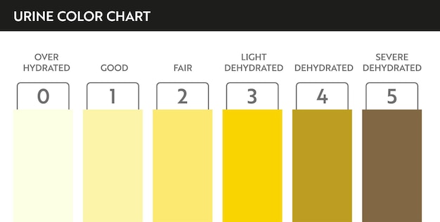 Vector urine color chart. pee hydration and dehydration test strip. vector design for medical education poster.