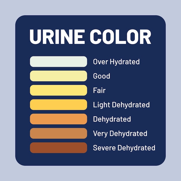 Vettore segnaletica a colori del test delle urine