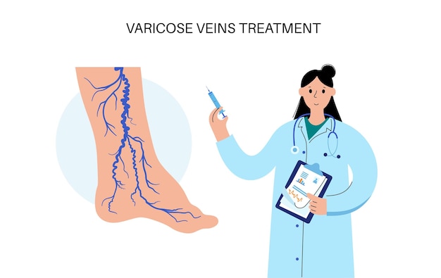 Vector varicose veins treatment