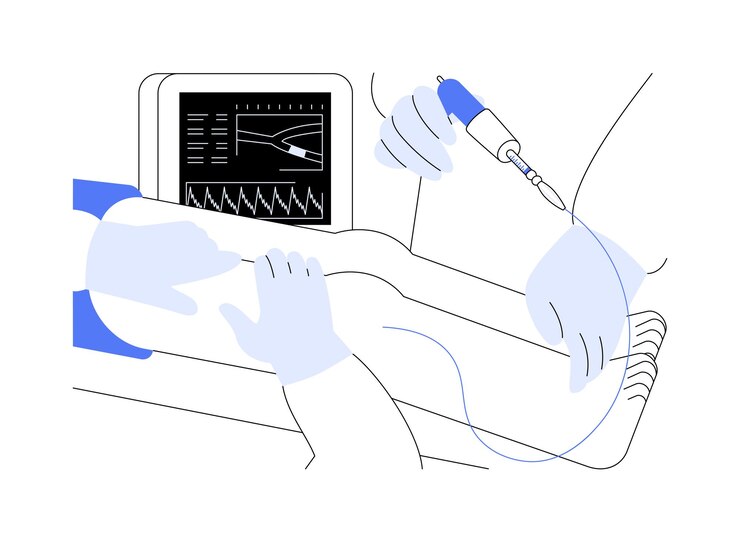 Vector vascular surgery abstract concept vector illustration