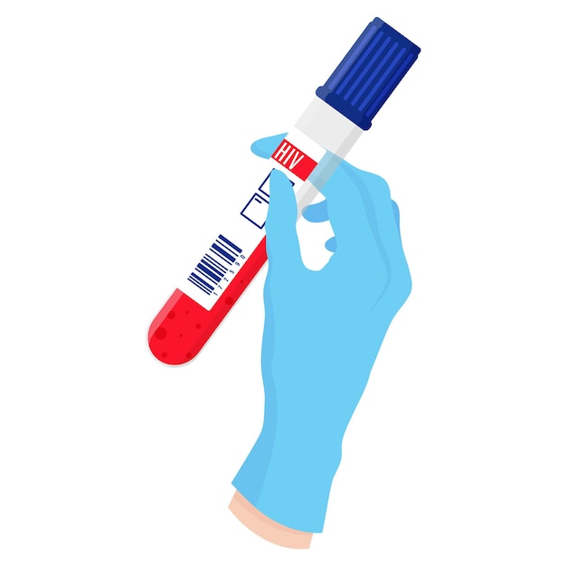 Vector cartoon doctors hand in blue glove holding test tube with blood. AIDS and HIV campaign.