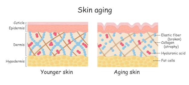 Vector diagram with schemes of two types of skin for healthcare illustrations