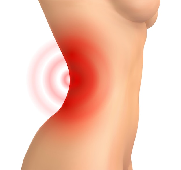 Векторное женское тело на белом фоне боли в пояснице