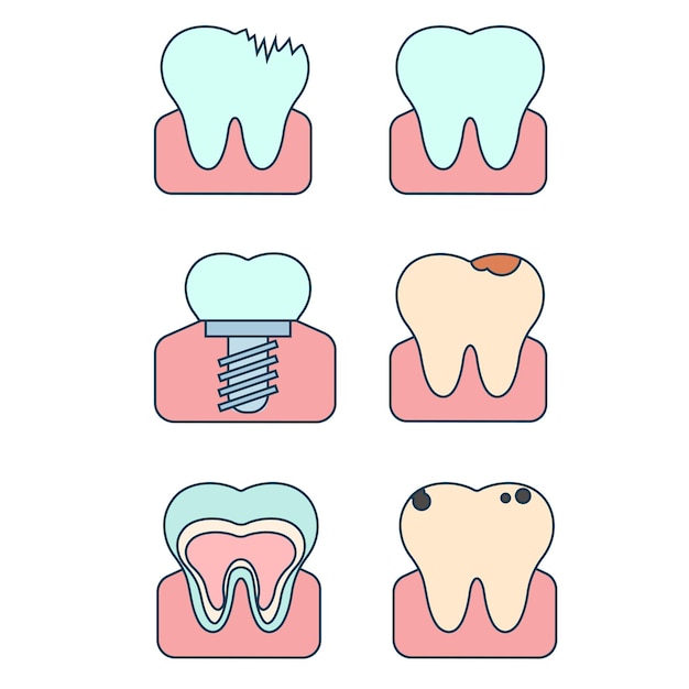 Vector flat illustration of teeth in various states Healthy diseased tooth