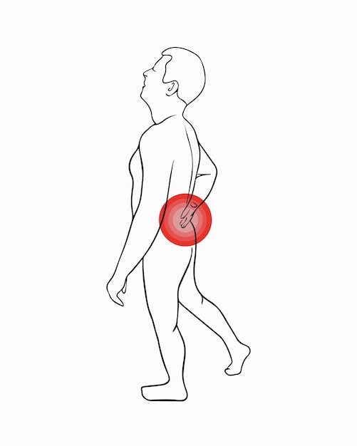 Vector geïsoleerde illustratie van rugpijn Overzichtstekening van een man die zijn rug vasthoudt
