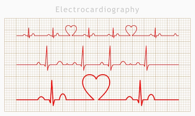 Vector heart cardiogram charts set