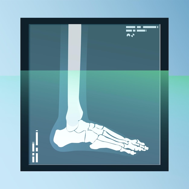 Vettore vettore di ossa umane, scheletro e articolazioni su foglio a raggi x. illustrazione di attrezzature mediche