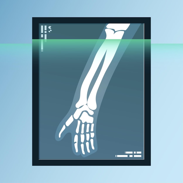 Vector vector of human bones, skeleton and joints on x-ray sheet. medical equipment illustration