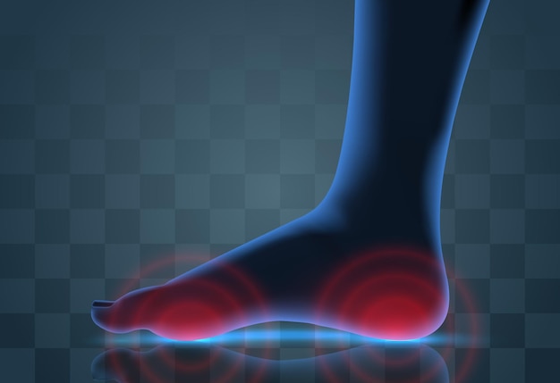 Vector vector human foot blue contour and red spots of pain ready element for medicine and orthopedics