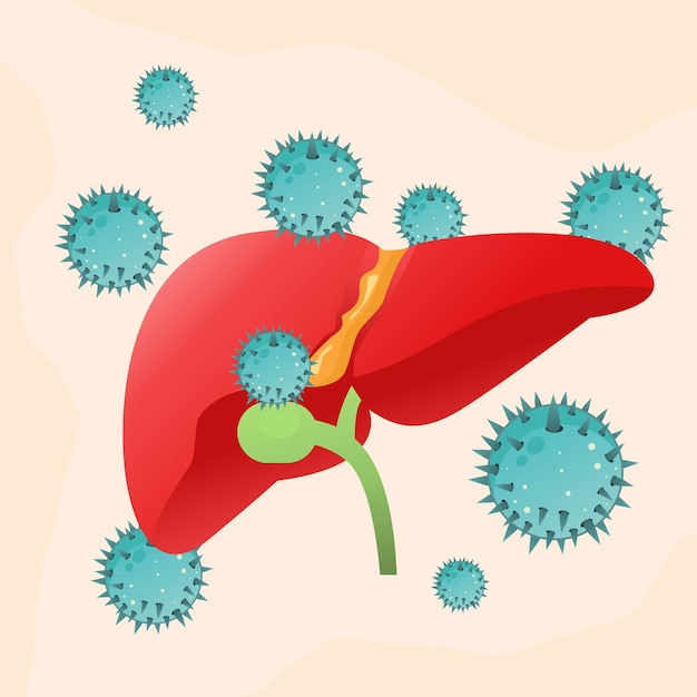 Vector illustratie hepatitis virussen aanvallende lever