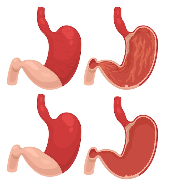 Вектор Векторная иллюстрация желудков в разных видах внутренней поверхности желудка пустой желудок