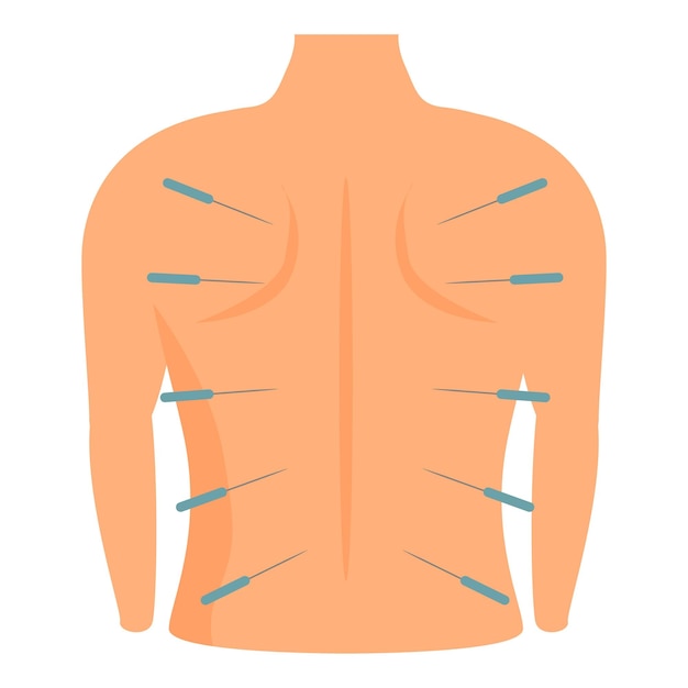 Vector illustration showing acupuncture needles on human back for alternative medicine