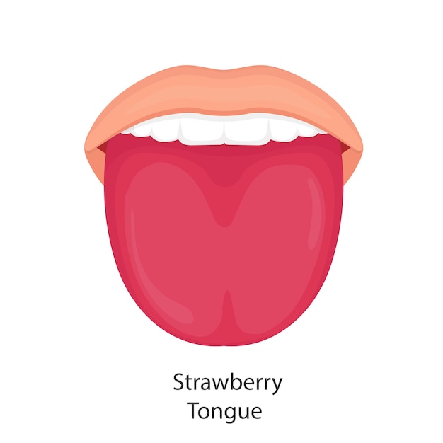 Vector vector illustration of strawberry tongue