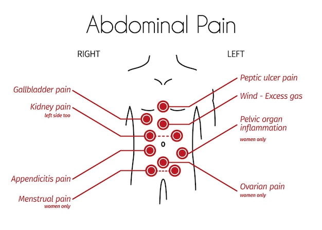 Vector vector infographic of abdominal pain types