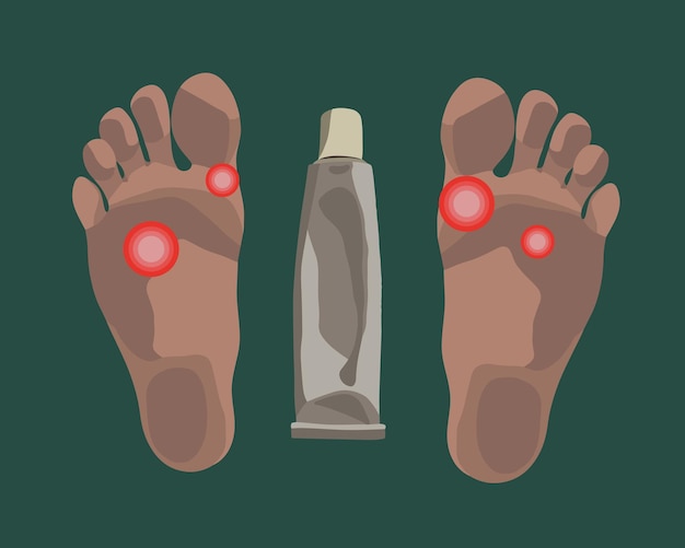 Vector vector isolated illustration of foot fungus fungal ointment