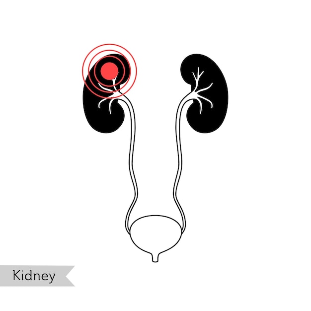 腎臓のベクトル分離イラスト