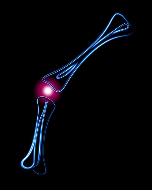 Vettore illustrazione vettoriale isolata del dolore al ginocchio disegno al neon del contorno dell'articolazione del ginocchio con un segno di dolore