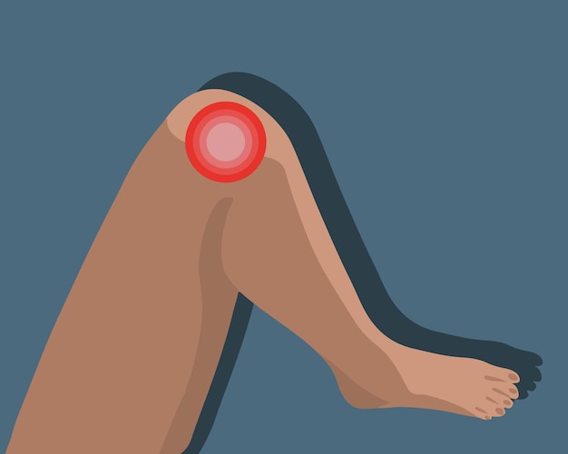 Vector isolated illustration of knee pain Localization of knee pain