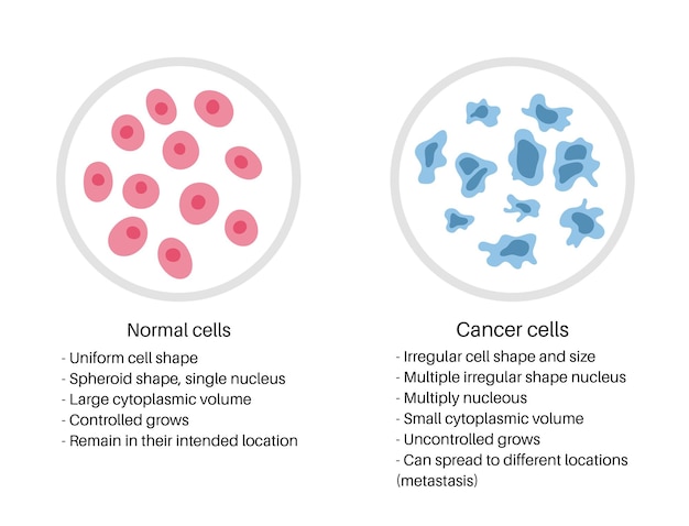 ベクトル 細胞構造のベクトル分離イラスト：正常と癌。ポスター、教育、科学、医療用の医療図。がんのアイコンまたはロゴ。