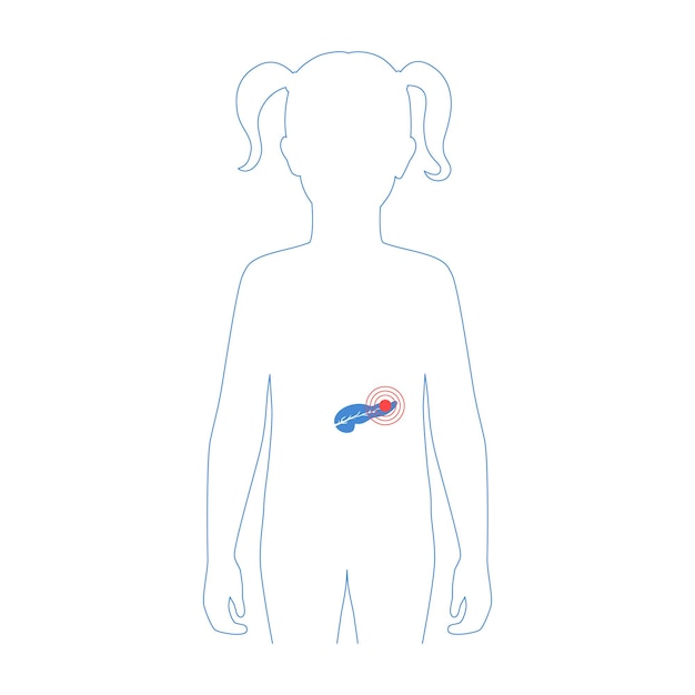 ベクトル 膵臓のベクトル分離イラスト