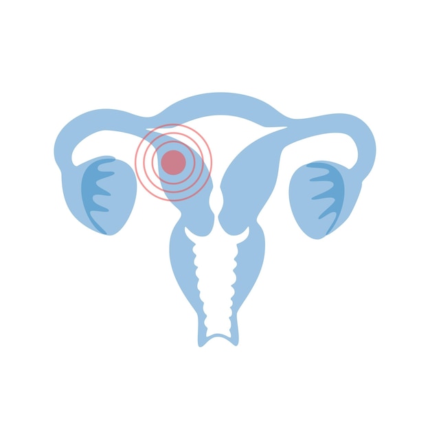 Vector vector isolated illustration of uterus with pain