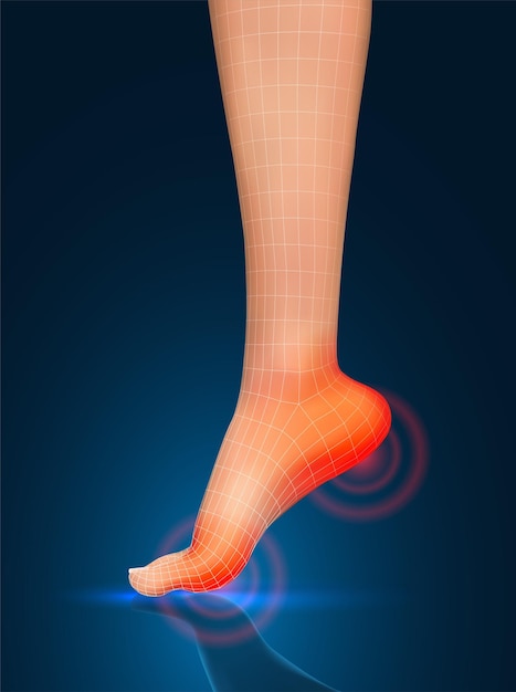 Vector menselijke voetrode vlekken van pijn klaar element voor geneeskunde en orthopedie