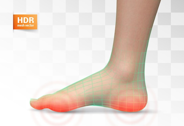 Vector menselijke voetrode vlekken van pijn klaar element voor geneeskunde en orthopedie