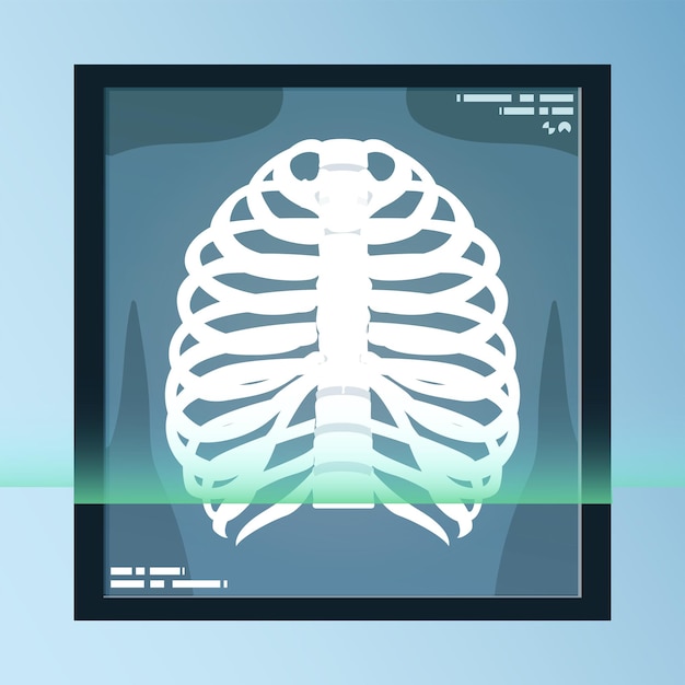 X線シート上の人間の骨、骨格、関節のベクトル。医療機器イラスト