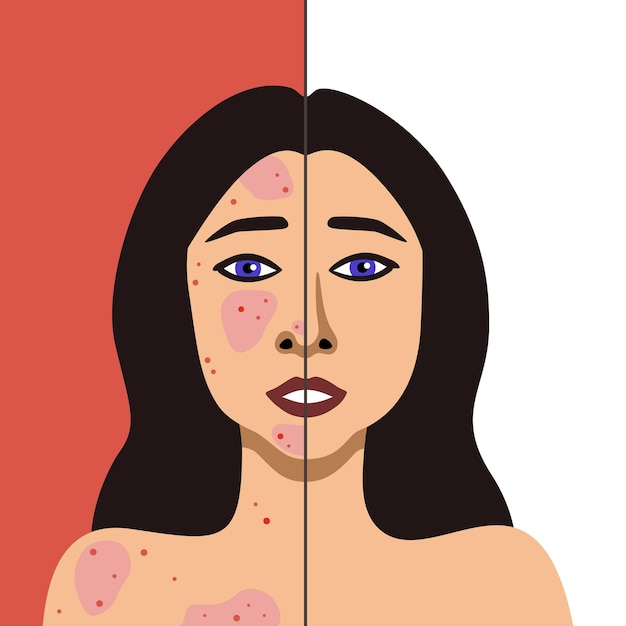 Vector vectorbeeld van een europese vrouw voor en na acne huidbehandeling minimalistische illustratie