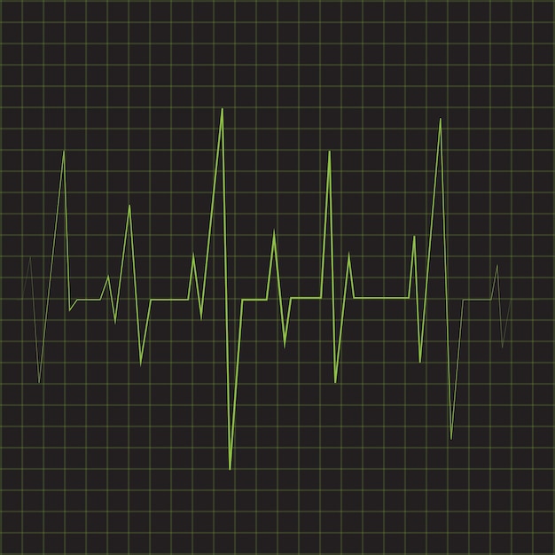 Vectorcardiogram