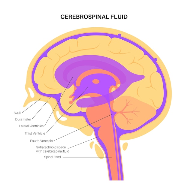 Vector ventricular system