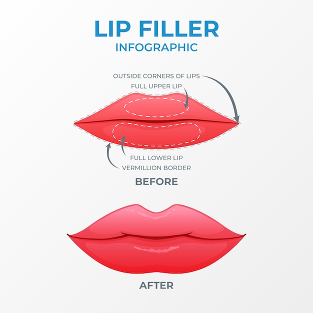 Vector verloop lipvuller infographic