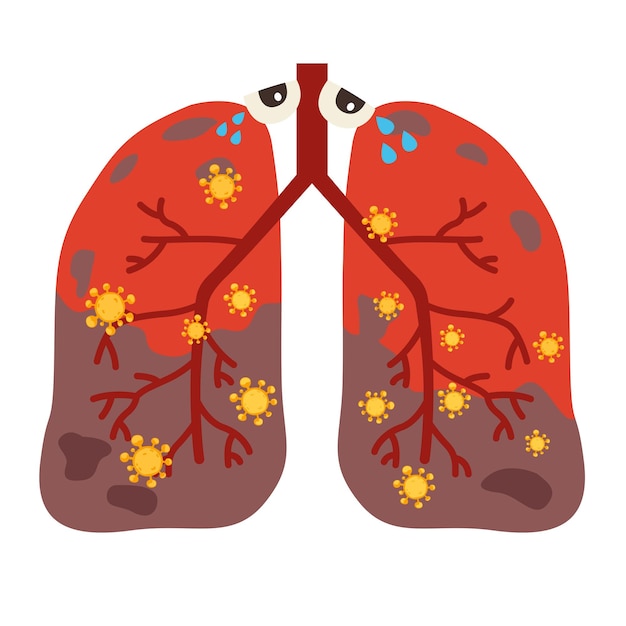Vettore virus o batteri infetta lungsvirus invade i polmoni
