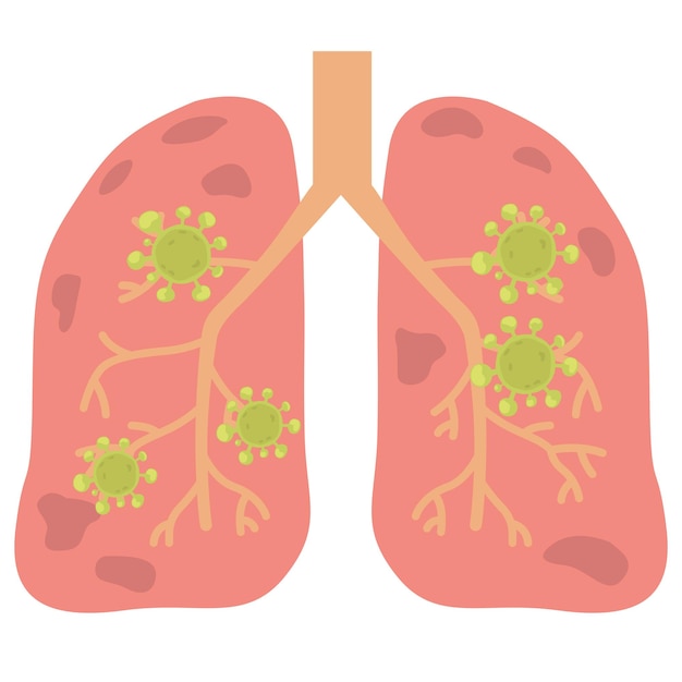 Vector virus or bacterial infects lungsvirus invades lungs