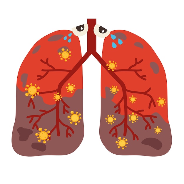 ベクトル ウイルスまたは細菌が肺に感染する ウイルスが肺に侵入する