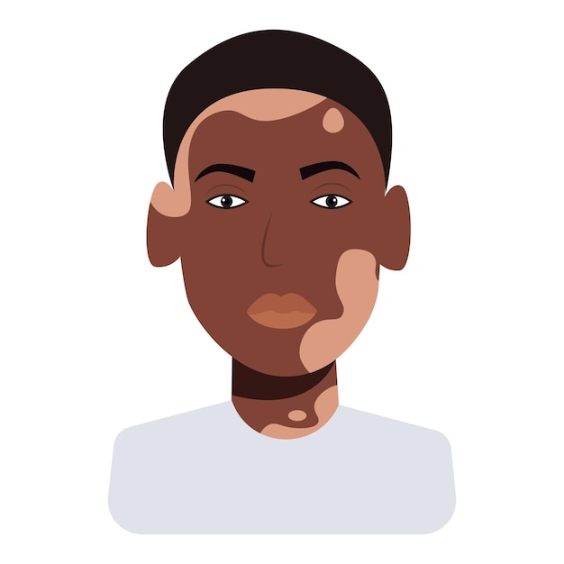 Vector vitiligo man vector illustration